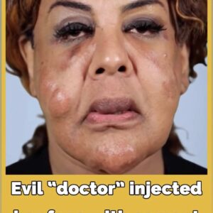 What “Cement Face” lady looks like 21 years later