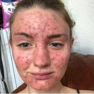 I Thought It Was Just a Rash… Then Everything Changed