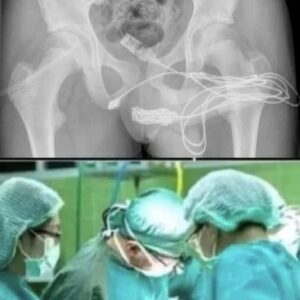 Curious Teenager Hospitalized After Making a Dangerous Mistake with an Everyday Household Object Leading to Urgent Warnings from Top Surgeons –