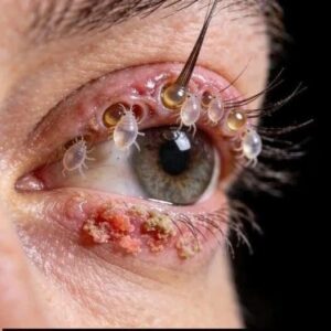 These are the consequences of sleeping with your
