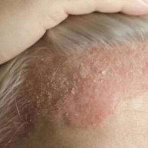 These Are The Hidden Consequences of Sleeping With…